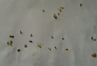 Jak wyglądają jaja robaków